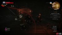 You can dispatch Igor easily enough by spamming strong attacks and dodge.
