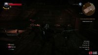 Picking a fight with the bandits will have consequences shortly,